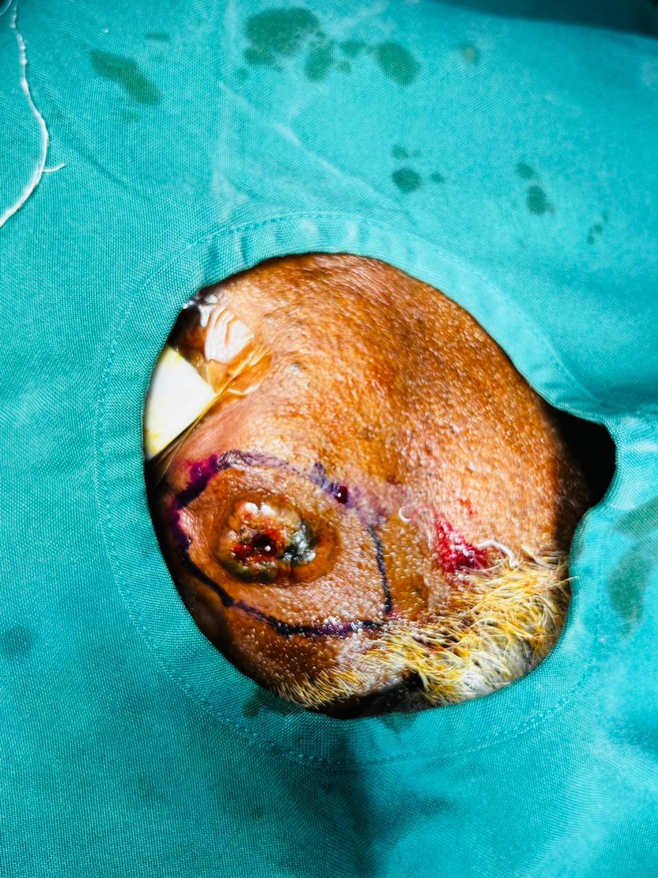 Nose tumor before surgery